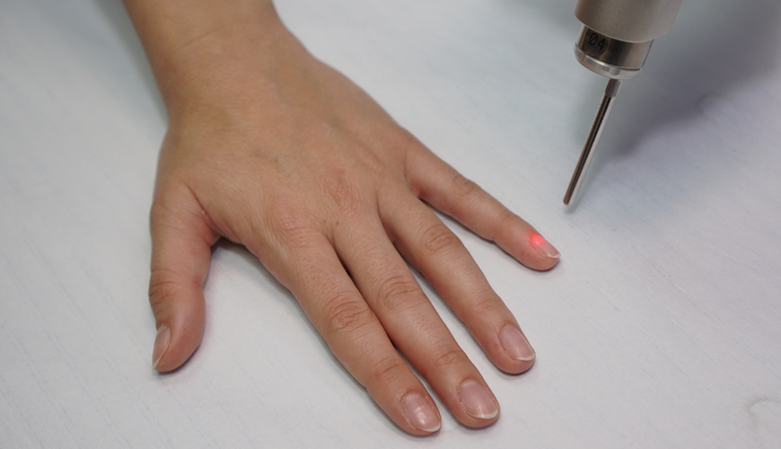лазерно лечение на гъбички по ноктите